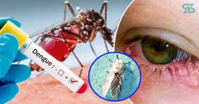  गण्डकी प्रदेशमा एकैसाथ डेङ्गी र सापुको जोखिम, कसरी जोगिने ? 