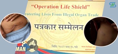  भारतमा नेपालीको मिर्गौला बेच्ने गिरोहका मुख्य नाइके पक्राउ 
